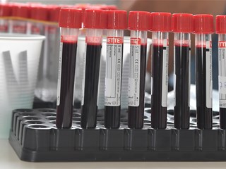 Priopćenje za medije HNS-a