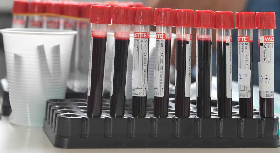 Priopćenje za medije HNS-a