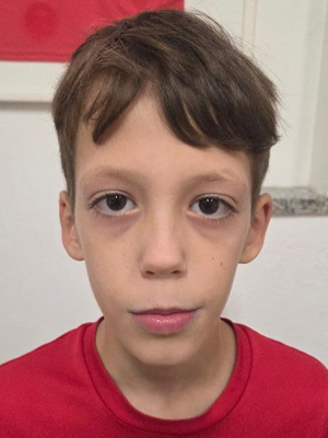 Duje Čagalj