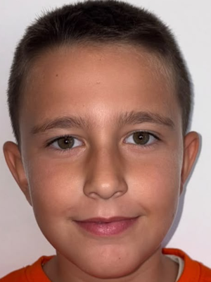 Jakov Galić