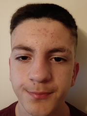 Leon Emanuel Matana Bilić