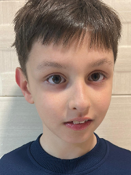 Moreno Božović Kofler